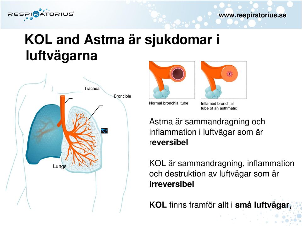 luftvägar som är reversibel Lungs KOL är sammandragning, inflammation