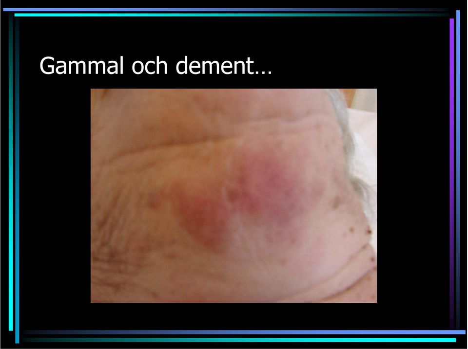 dement