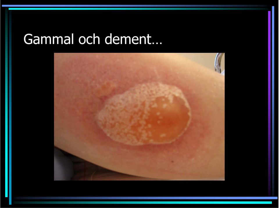 dement