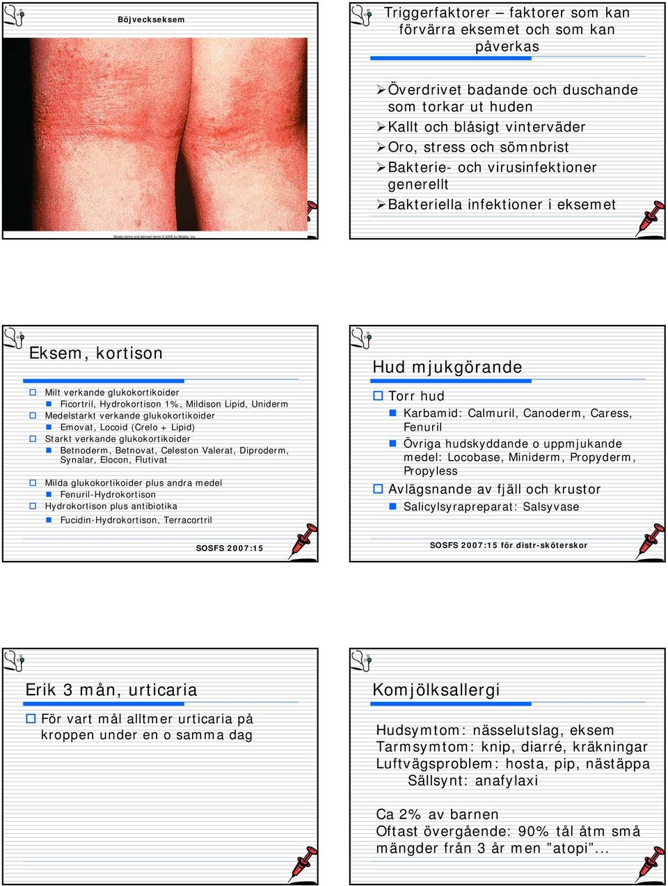 Medelstarkt verkande glukokortikoider Emovat, Locoid (Crelo + Lipid) Starkt verkande glukokortikoider Betnoderm, Betnovat, Celeston Valerat, Diproderm, Synalar, Elocon, Flutivat Milda