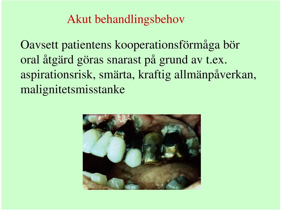 snarast på grund av t.ex.