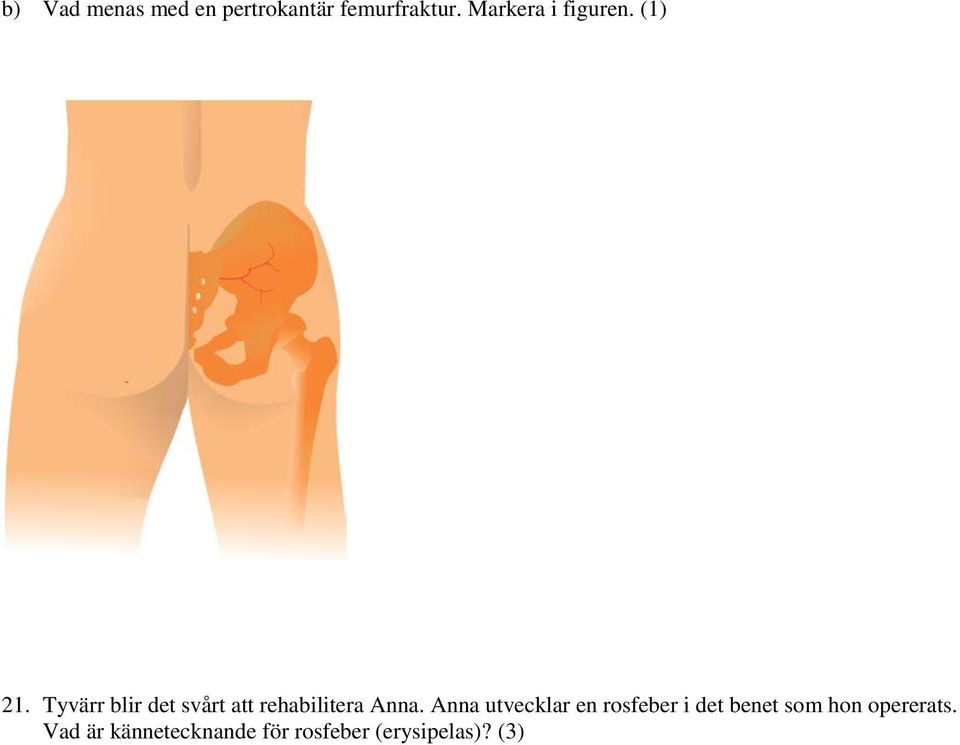 Tyvärr blir det svårt att rehabilitera Anna.