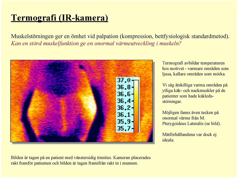 Termograf avbldar temperaturen hos motvet - varmare områden som ljusa, kallare områden som mörka.