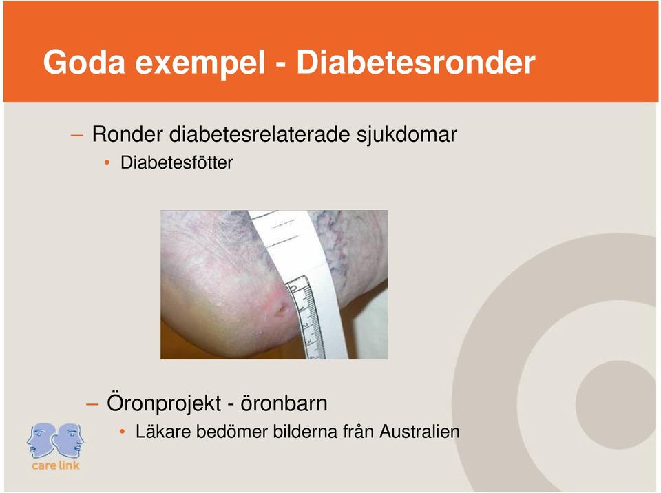 Diabetesfötter Öronprojekt -