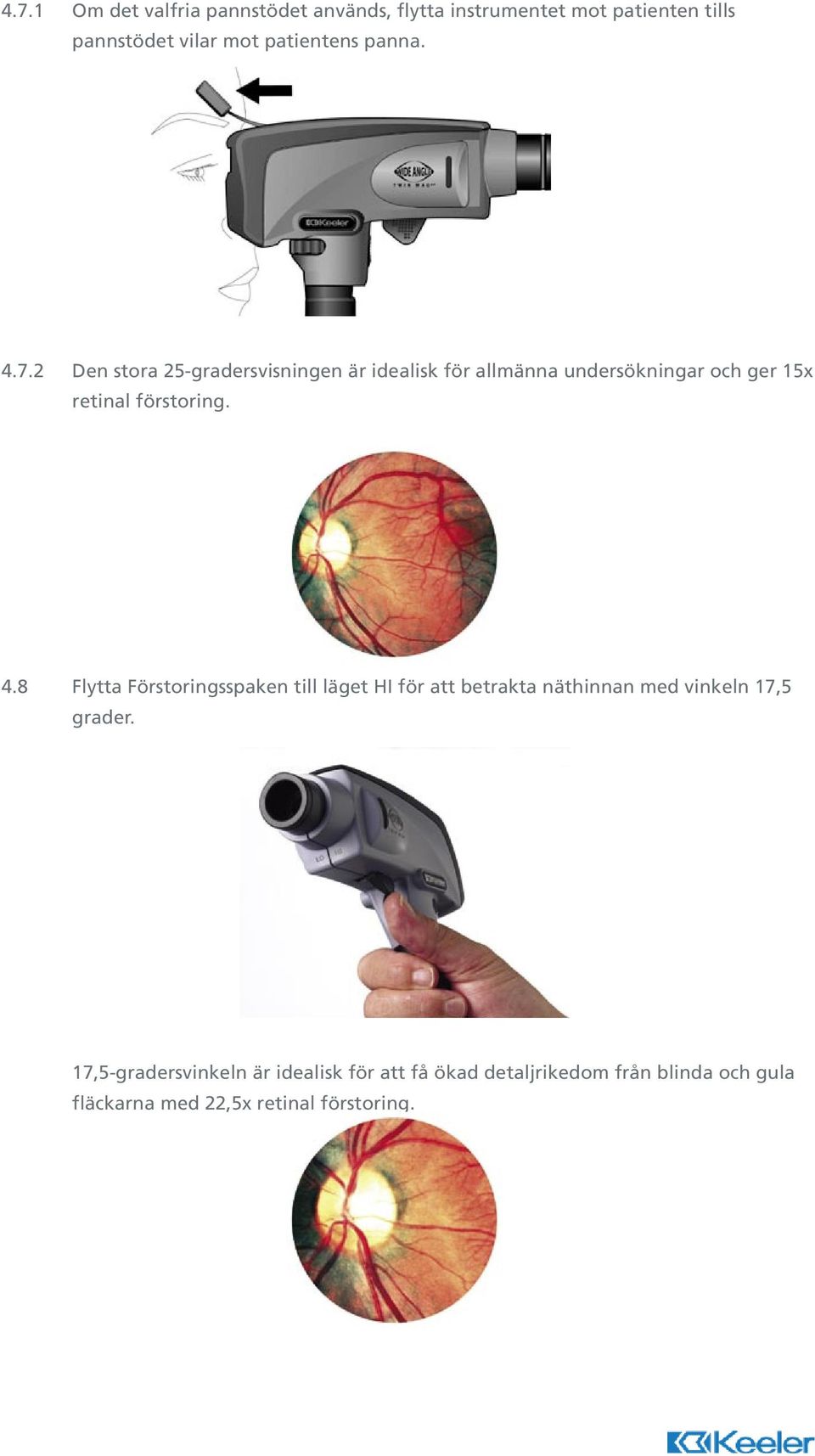 2 Den stora 25-gradersvisningen är idealisk för allmänna undersökningar och ger 15x retinal förstoring. 4.