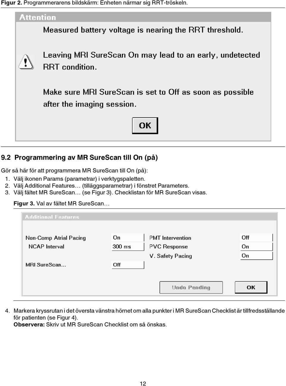 Välj ikonen Params (parametrar) i verktygspaletten. 2. Välj Additional Features (tilläggsparametrar) i fönstret Parameters. 3.