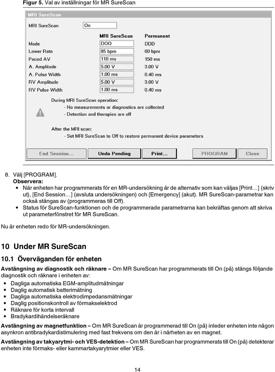 MR SureScan-parametrar kan också stängas av (programmeras till Off).