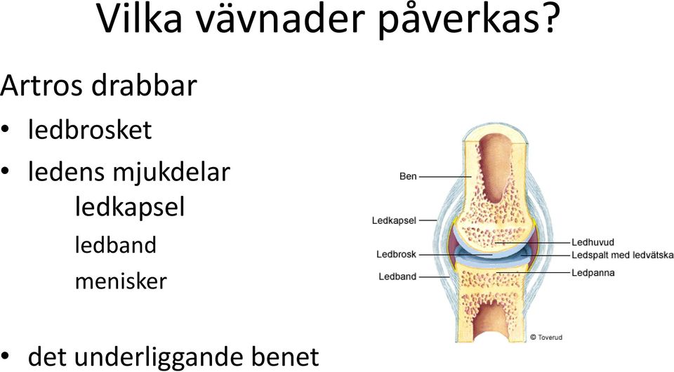 ledens mjukdelar ledkapsel