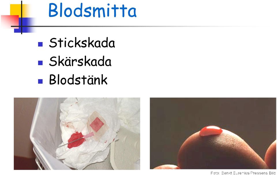 Skärskada