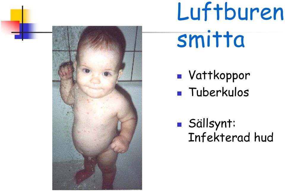 Vattkoppor