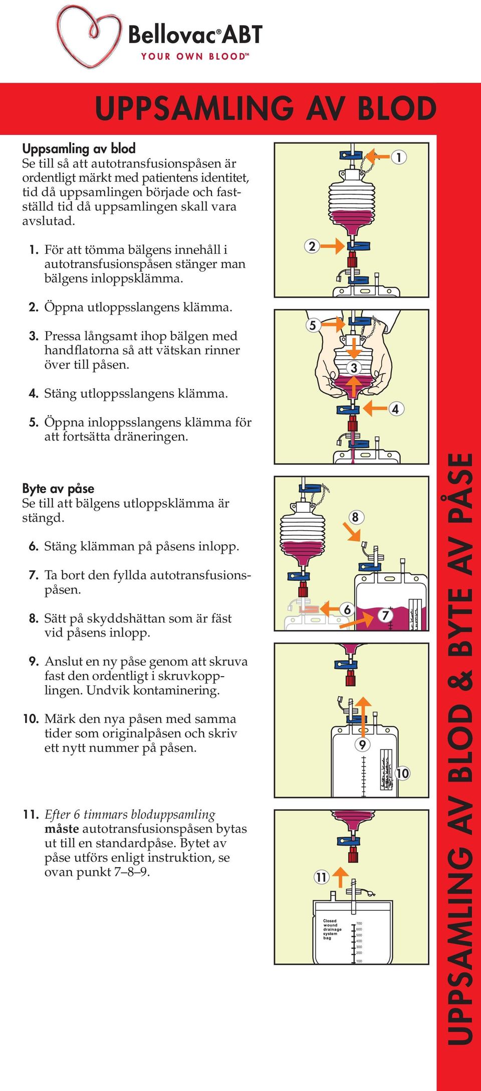 . Pressa långsamt ihop bälgen med handflatorna så att vätskan rinner över till påsen.. Stäng utloppsslangens klämma.. Öppna inloppsslangens klämma för att fortsätta dräneringen.