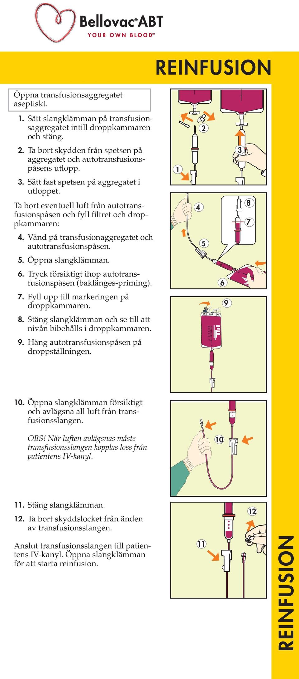 Ta bort eventuell luft från autotransfusionspåsen och fyll filtret och droppkammaren:. Vänd på transfusionaggregatet och autotransfusionspåsen.. Öppna slangklämman.