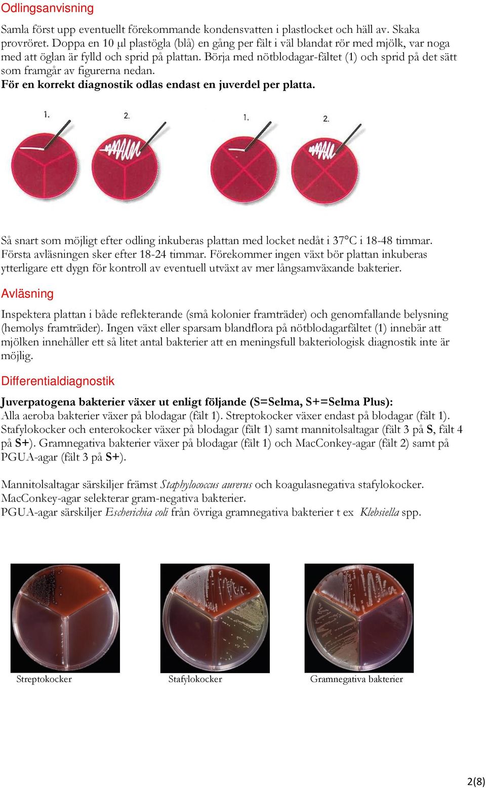 Börja med nötblodagar-fältet (1) och sprid på det sätt som framgår av figurerna nedan. För en korrekt diagnostik odlas endast en juverdel per platta.