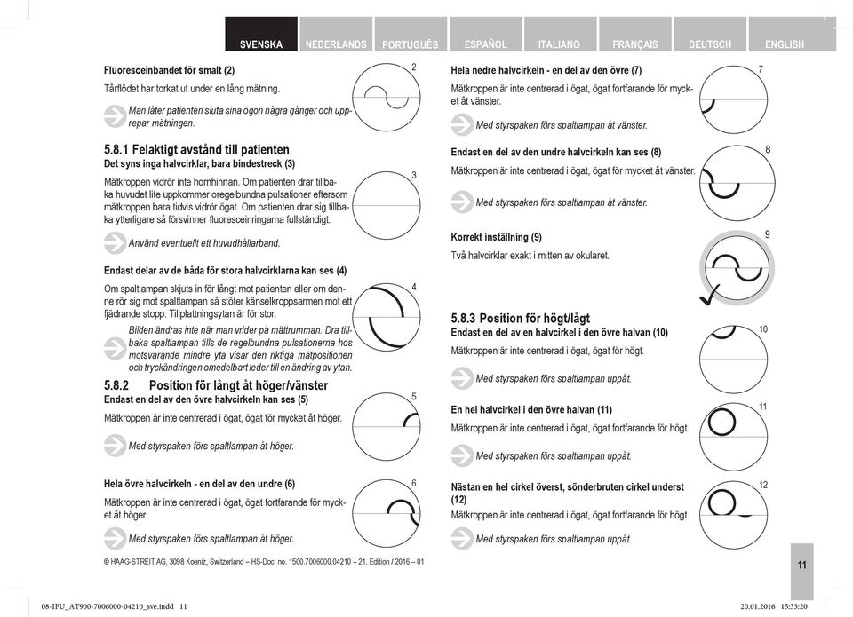 Om patienten drar tillbaka huvudet lite uppkommer oregelbundna pulsationer eftersom mätkroppen bara tidvis vidrör ögat.