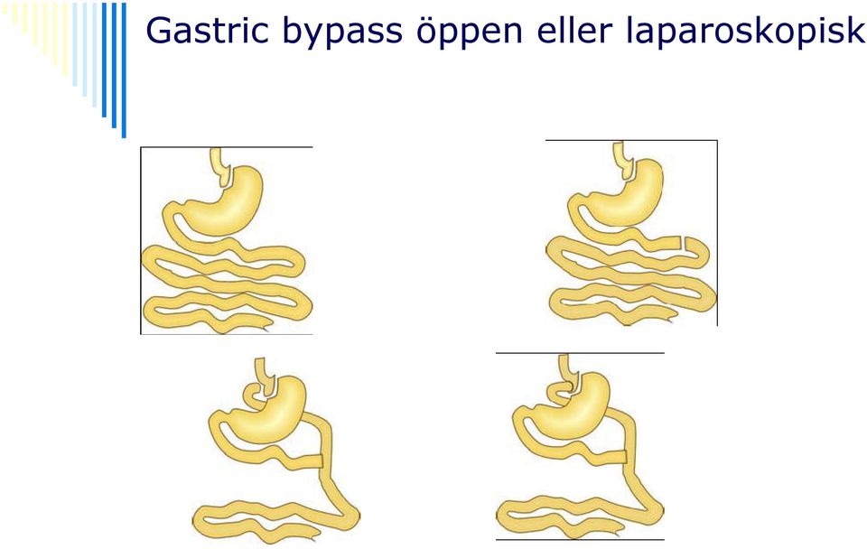 öppen