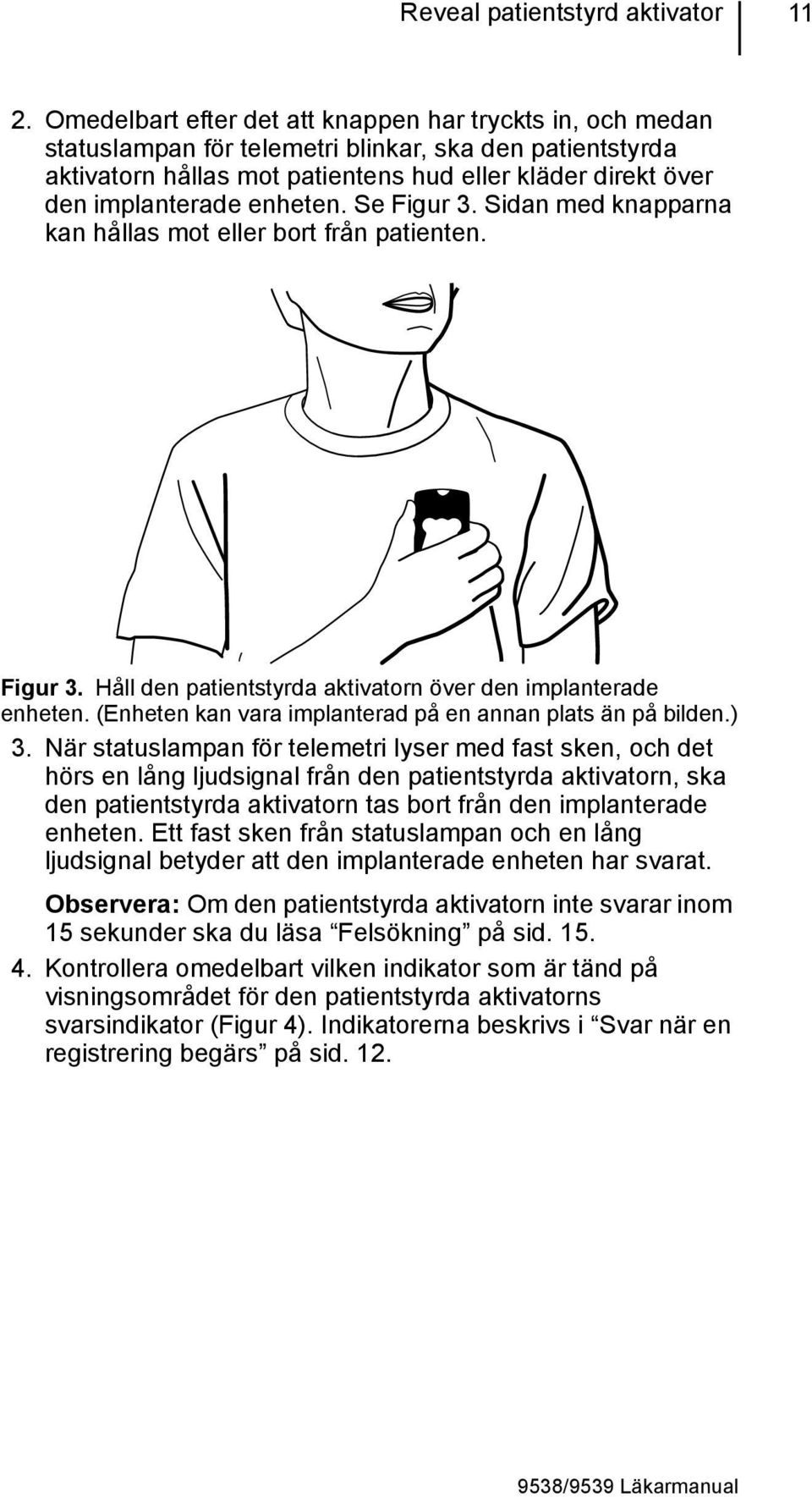 enheten. Se Figur 3. Sidan med knapparna kan hållas mot eller bort från patienten. Figur 3. Håll den patientstyrda aktivatorn över den implanterade enheten.