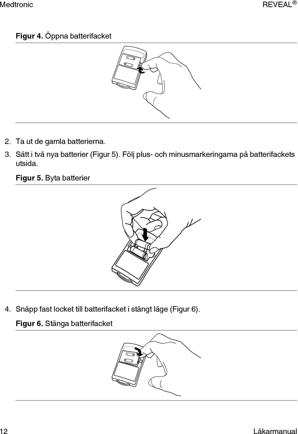 Följ plus- och minusmarkeringarna på batterifackets utsida. Figur 5.