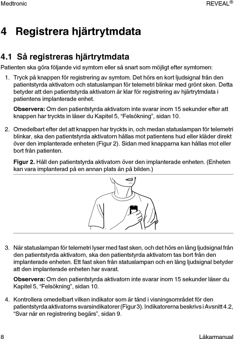 Detta betyder att den patientstyrda aktivatorn är klar för registrering av hjärtrytmdata i patientens implanterade enhet.