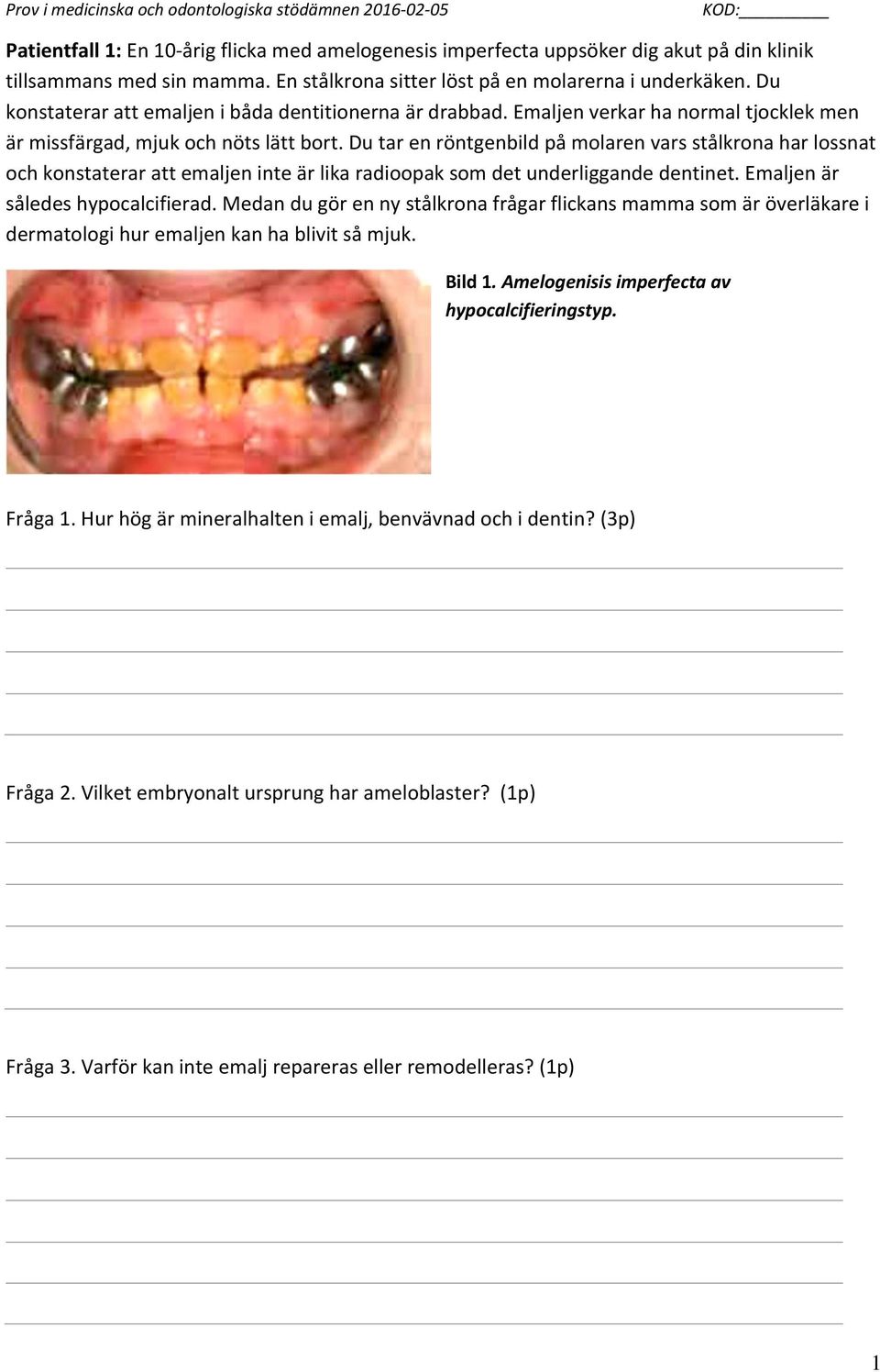 Du tar en röntgenbild på molaren vars stålkrona har lossnat och konstaterar att emaljen inte är lika radioopak som det underliggande dentinet. Emaljen är således hypocalcifierad.