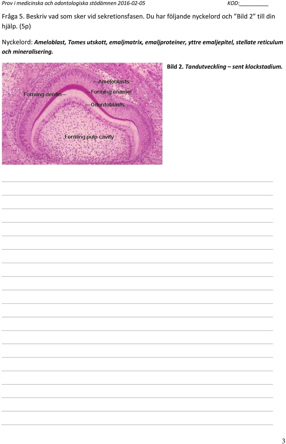 (5p) Nyckelord: Ameloblast, Tomes utskott, emaljmatrix,