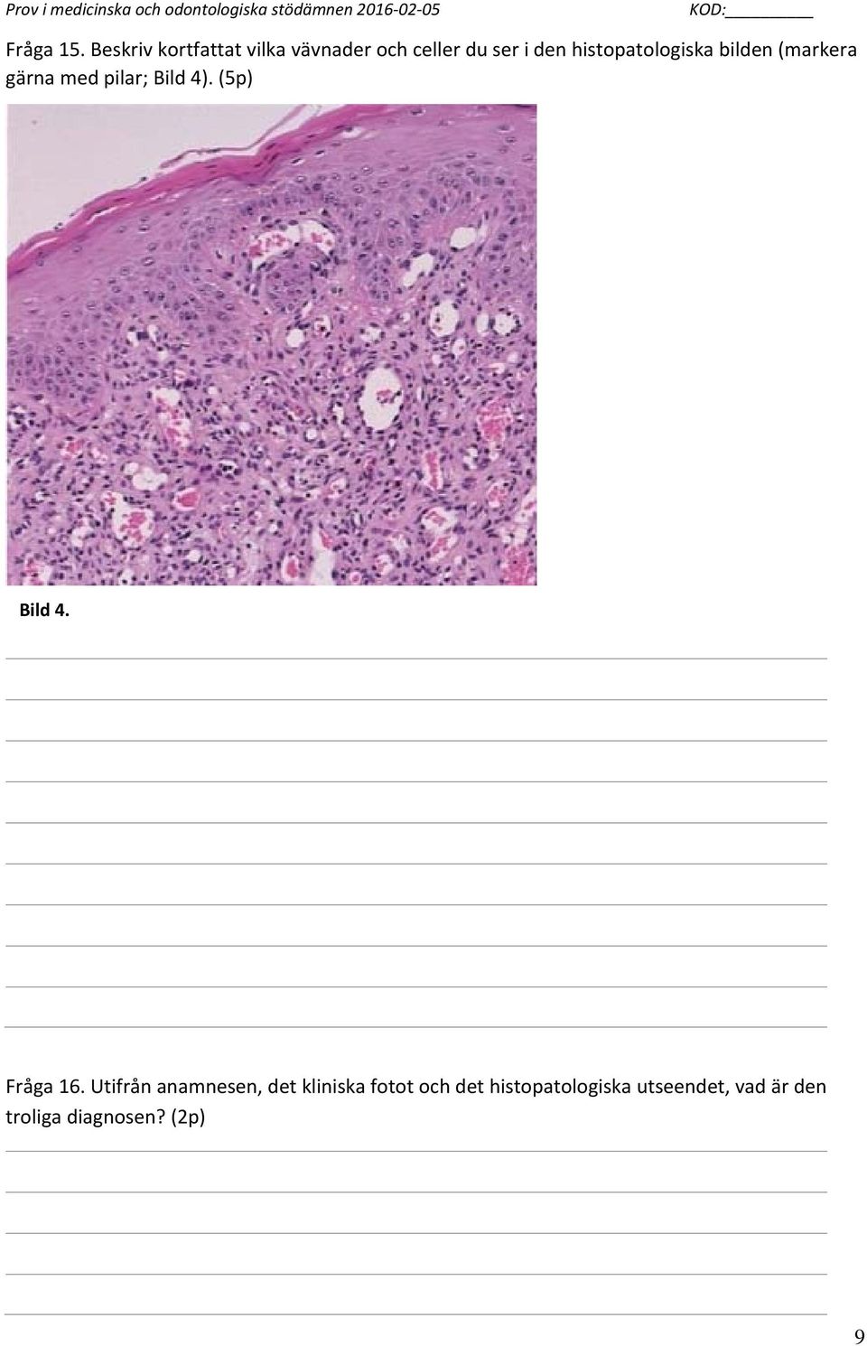 histopatologiska bilden (markera gärna med pilar; Bild 4).