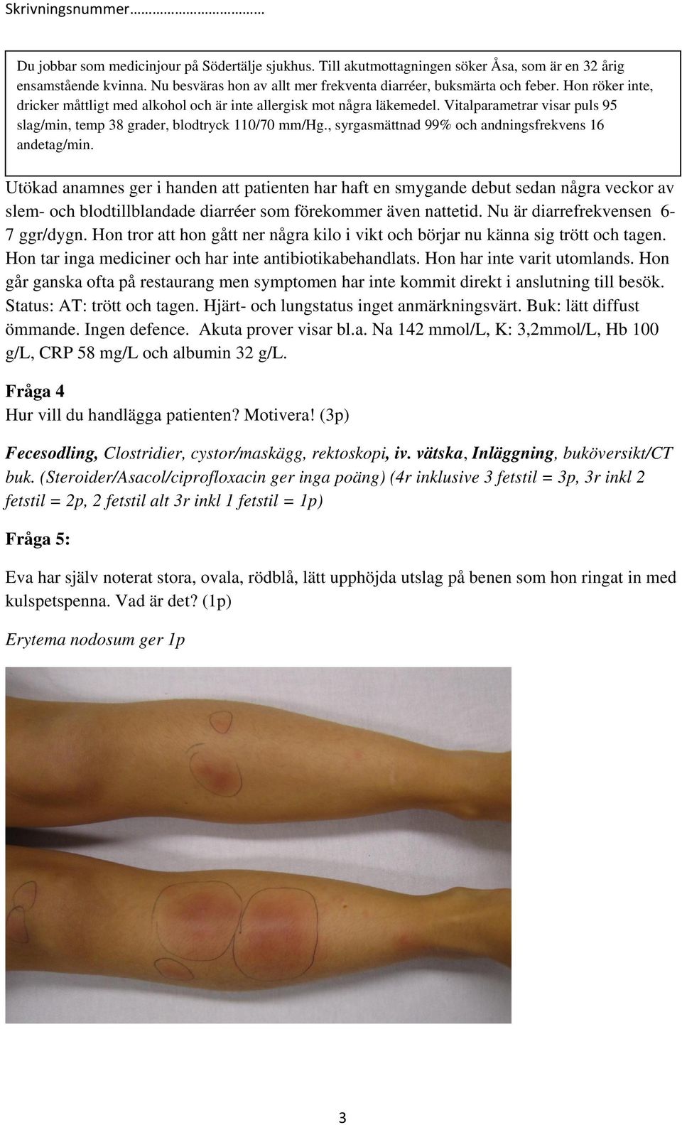 Utökad anamnes ger i handen att patienten har haft en smygande debut sedan några veckor av slem- och blodtillblandade diarréer som förekommer även nattetid. Nu är diarrefrekvensen 6-7 ggr/dygn.