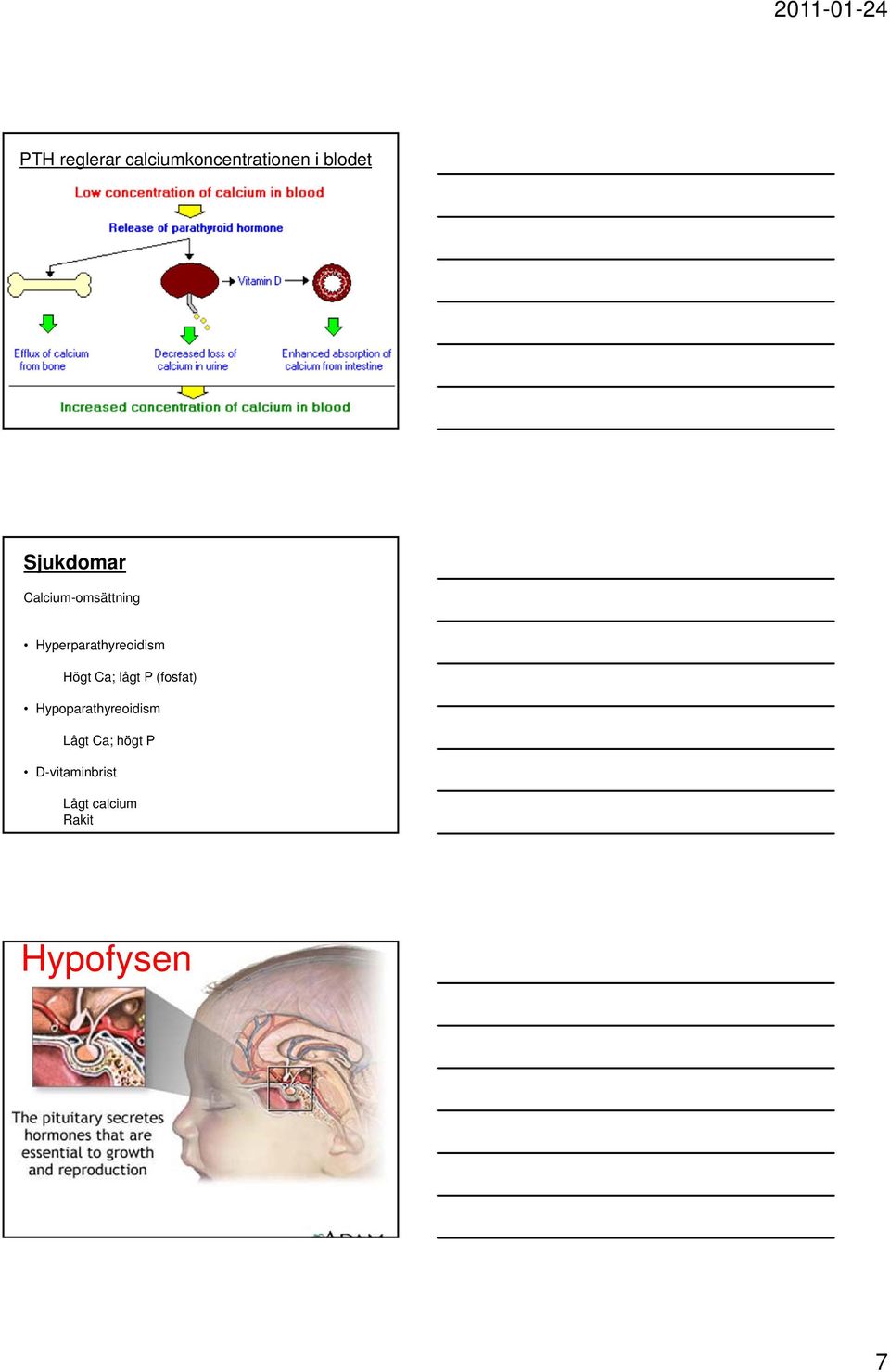 Högt Ca; lågt P (fosfat) Hypoparathyreoidism Lågt