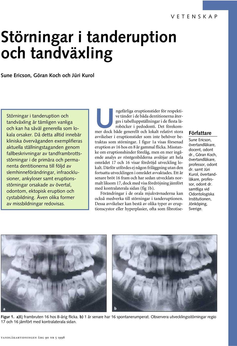 Då dett lltid inneär klinisk övervägnden exemplifiers ktuell ställningstgnden genom flleskrivningr v tndfrmrottsstörningr i de primär och permnent dentitionern till följd v slemhinneförändringr,