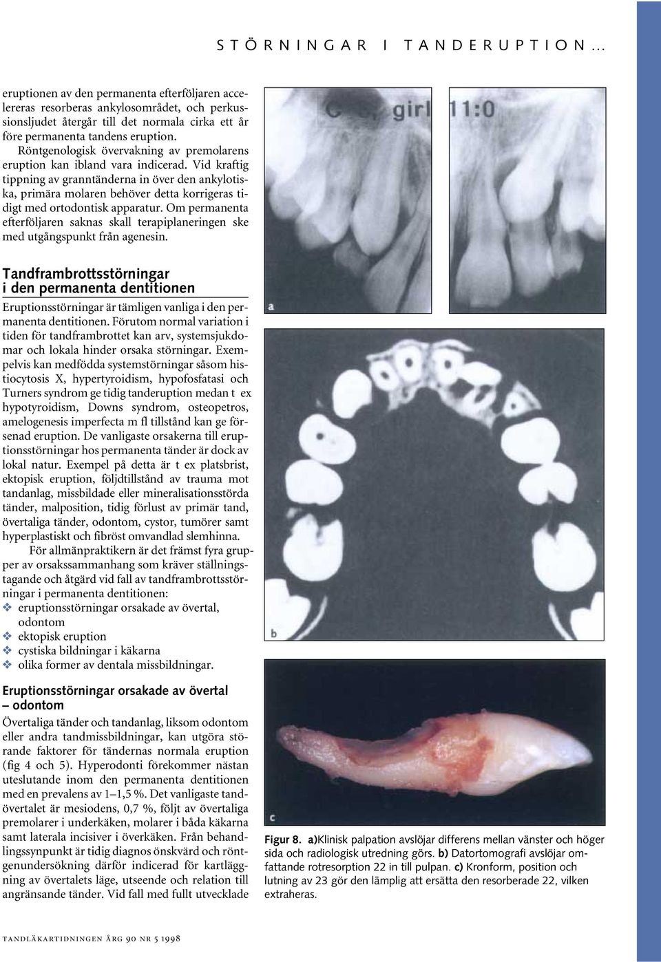 Om permnent efterföljren skns skll terpiplneringen ske med utgångspunkt från genesin. Tndfrmrottsstörningr i den permnent dentitionen Eruptionsstörningr är tämligen vnlig i den permnent dentitionen.