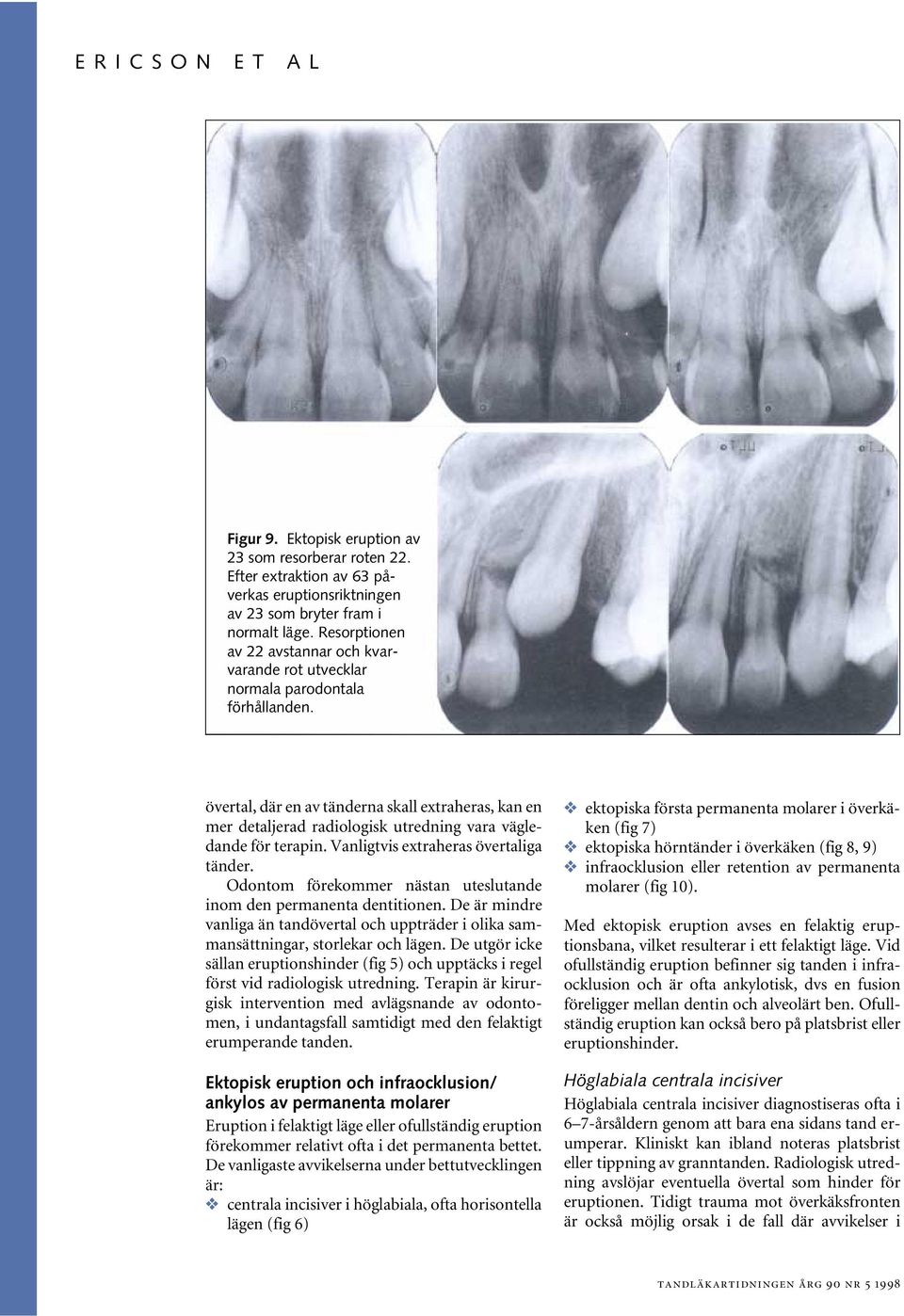 Vnligtvis extrhers övertlig tänder. Odontom förekommer nästn uteslutnde inom den permnent dentitionen. De är mindre vnlig än tndövertl och uppträder i olik smmnsättningr, storlekr och lägen.