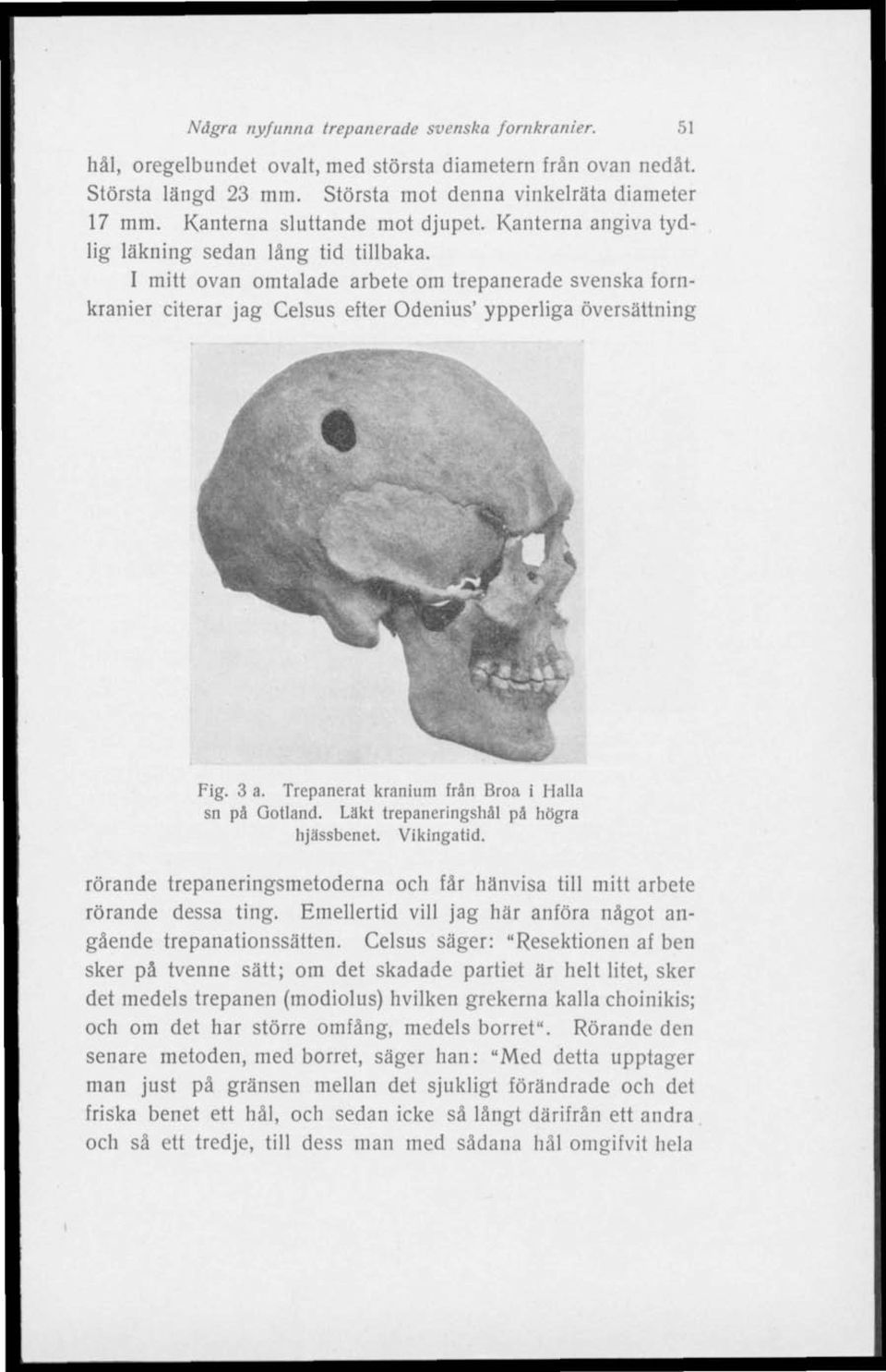 I mitt ovan omtalade arbete om trepanerade svenska fornkranier citerar jag Celsus efter Odenius' ypperliga översättning Fig. 3 a. Trepanerat kranium från Broa i Hälla sn på Gotland.