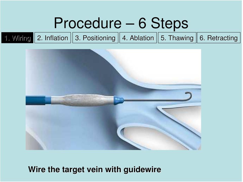 Ablation 5. Thawing 6.