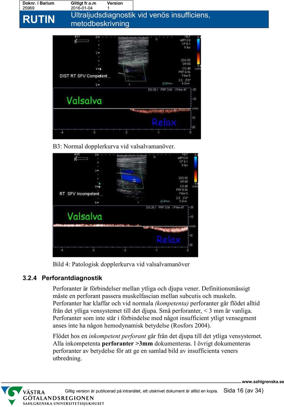 Perforanter har klaffar och vid normala (kompetenta) perforanter går flödet alltid från det ytliga vensystemet till det djupa. Små perforanter, < 3 mm är vanliga.