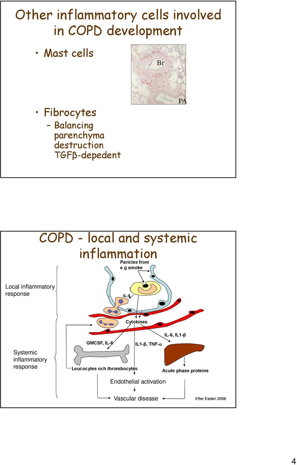 inflammatory response IL-8 Cytokines Systemic inflammatory response IL-6, IL1-β GMCSF, IL-6 IL1-β,
