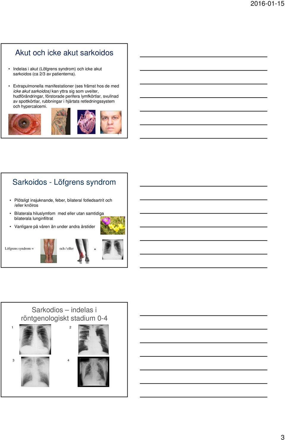 spottkörtlar, rubbningar i hjärtats retledningssystem och hypercalcemi.