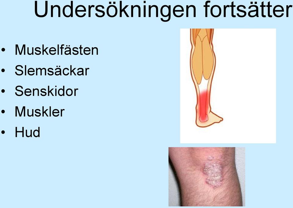 Muskelfästen