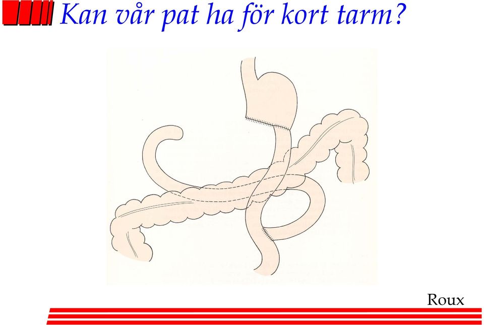 för kort