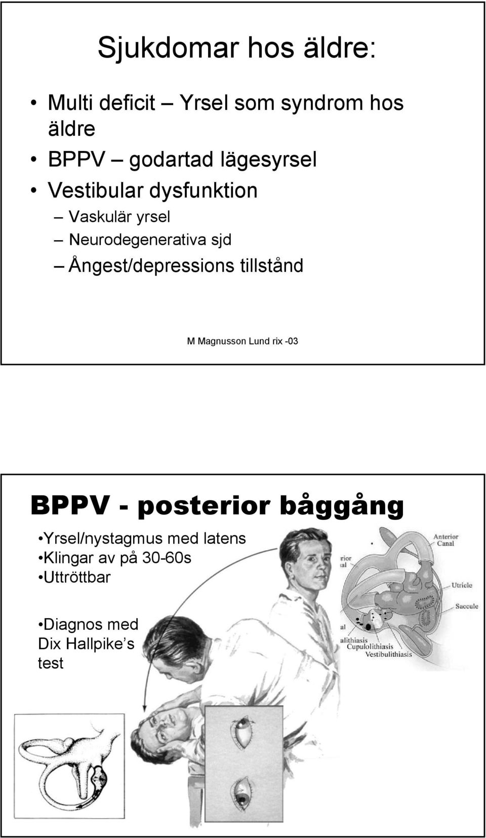 Neurodegenerativa sjd Ångest/depressions tillstånd BPPV - posterior