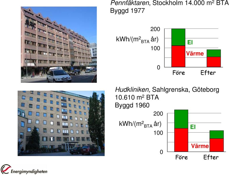 El Värme Före Efter Hudkliniken, Sahlgrenska,