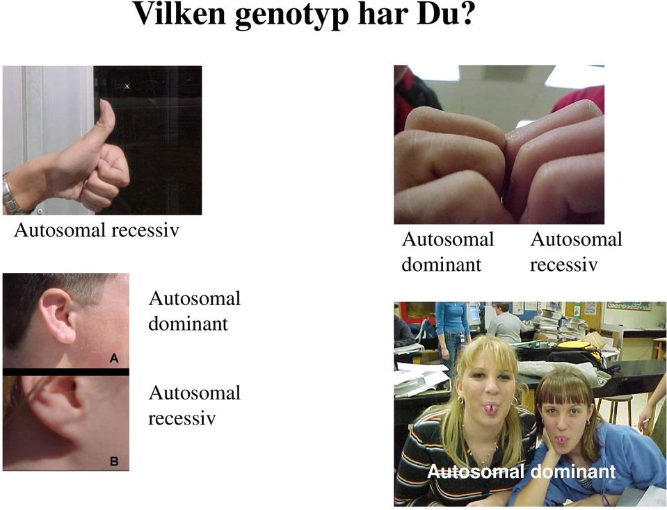 dominant Autosomal dominant 