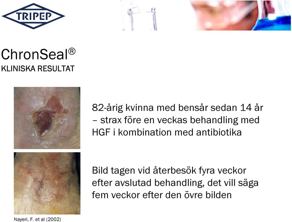 antibiotika Bild tagen vid återbesök fyra veckor efter avslutad