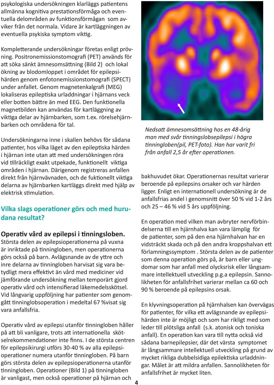 Positronemissionstomografi (PET) används för att söka sänkt ämnesomsättning (Bild 2) och lokal ökning av blodomloppet i området för epilepsihärden genom enfotonemissionstomografi (SPECT) under