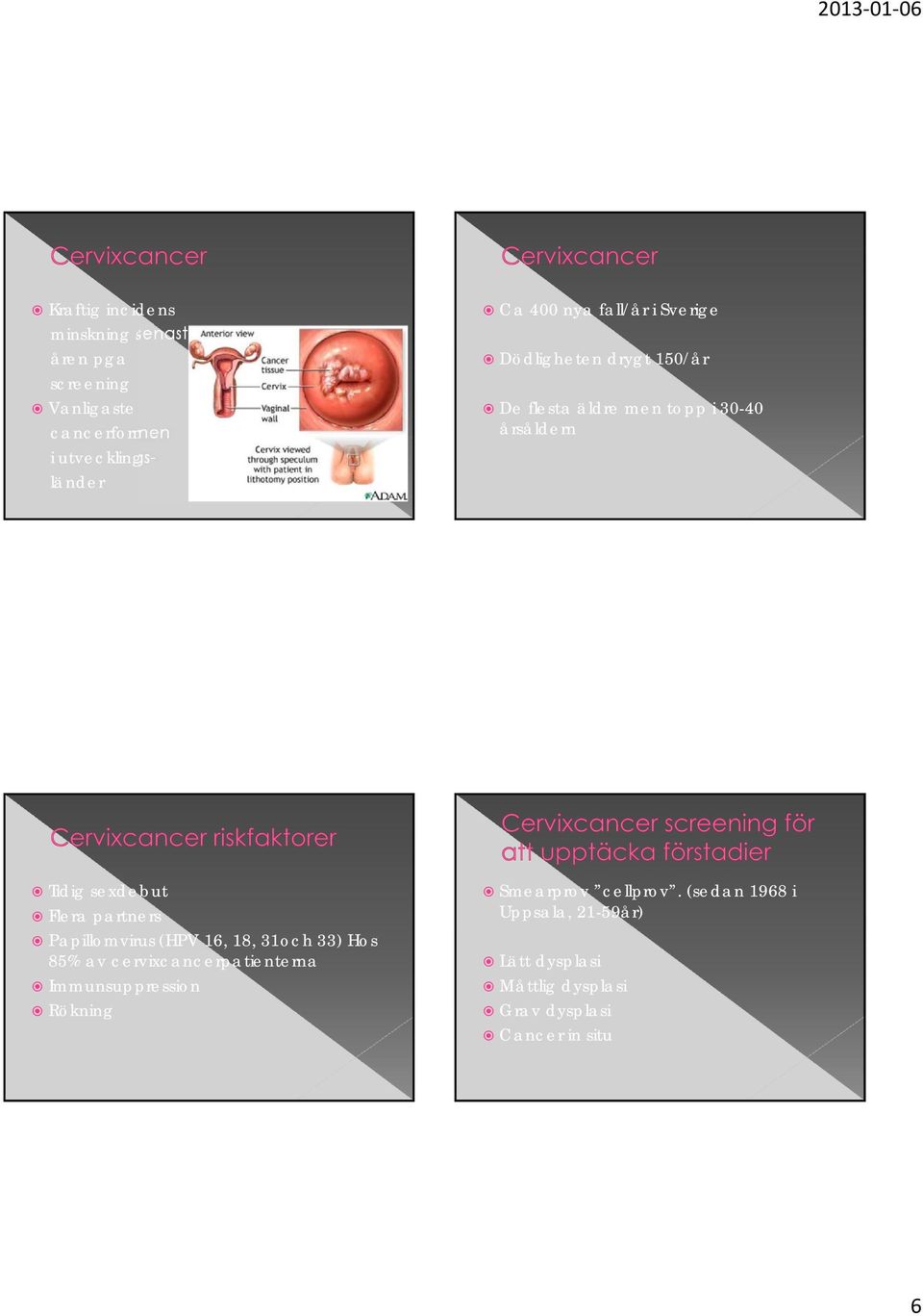 partners Papillomvirus (HPV 16, 18, 31och 33) Hos 85% av cervixcancerpatienterna Immunsuppression Rökning