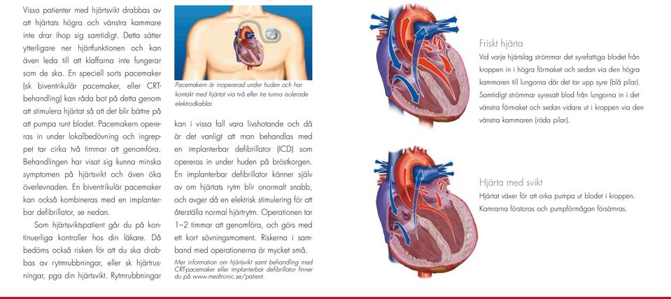 En speciell sorts pacemaker (sk biventrikulär pacemaker, eller CRTbehandling) kan råda bot på detta genom att stimulera hjärtat så att det blir bättre på att pumpa runt blodet.