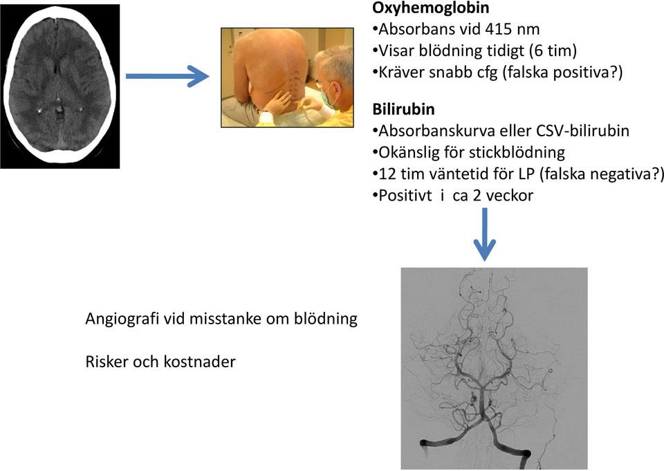 ) Bilirubin Absorbanskurva eller CSV bilirubin Okänslig g för