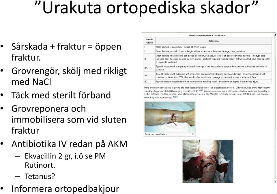 Grovreponera och immobilisera som vid sluten fraktur Antibiotika IV