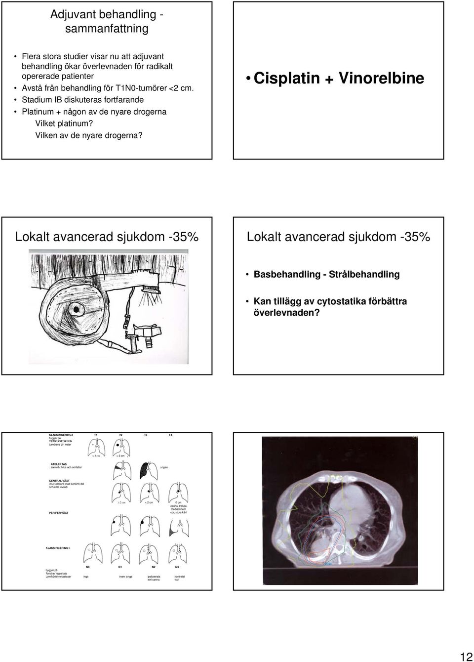 Cisplatin + Vinorelbine Lokalt avancerad sjukdom -35% Lokalt avancerad sjukdom -35% Basbehandling - Strålbehandling Kan tillägg av cytostatika förbättra överlevnaden?