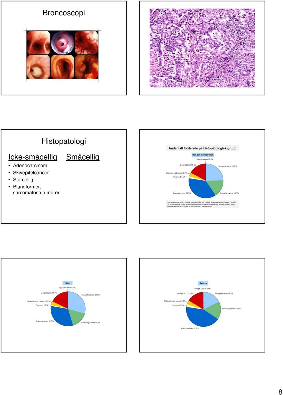 Skivepitelcancer Storcellig