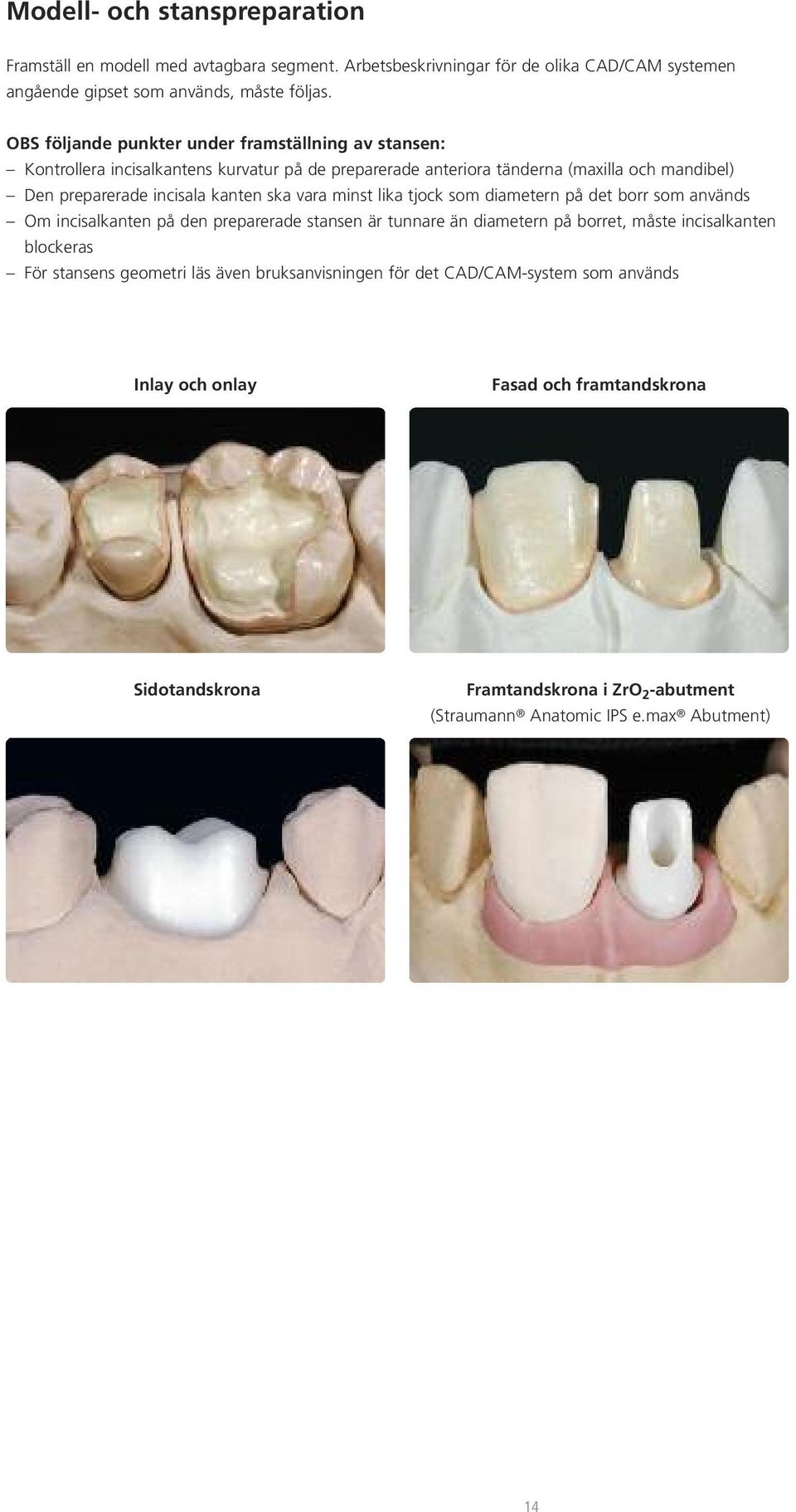 ska vara minst lika tjock som diametern på det borr som används Om incisalkanten på den preparerade stansen är tunnare än diametern på borret, måste incisalkanten blockeras För