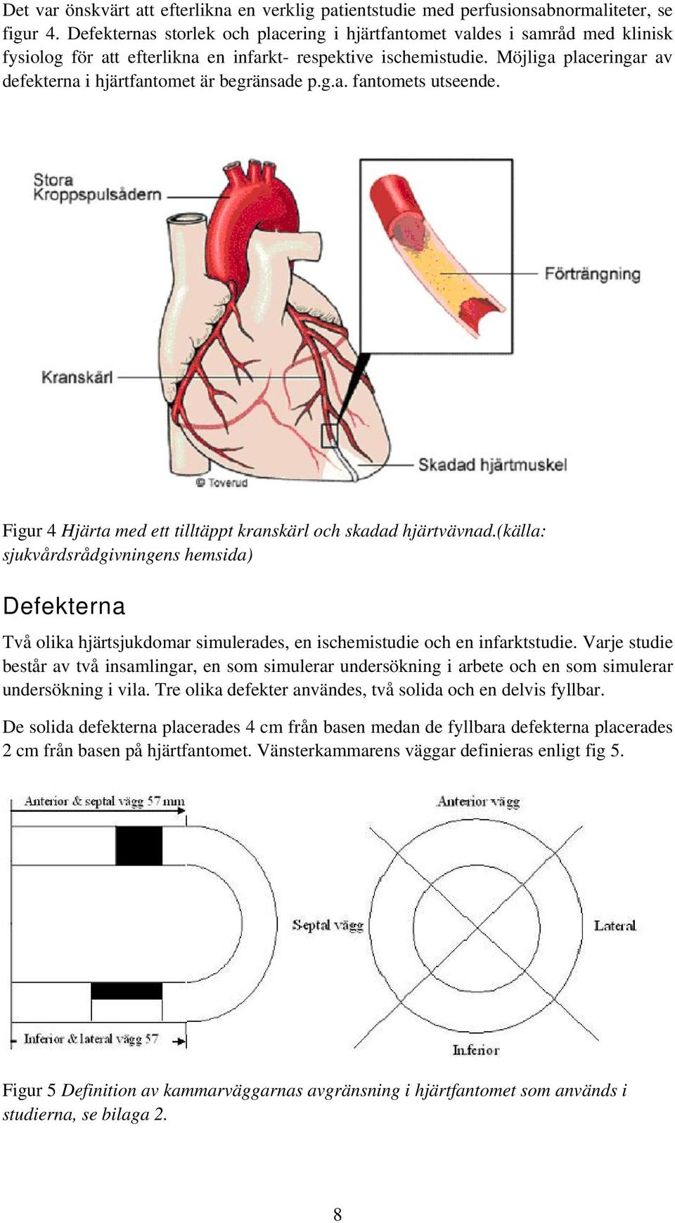 Möjliga placeringar av defekterna i hjärtfantomet är begränsade p.g.a. fantomets utseende. Figur 4 Hjärta med ett tilltäppt kranskärl och skadad hjärtvävnad.